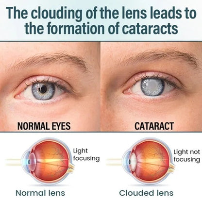 Reclaim Your Crystal-Clear Vision with Tavunae® NANO Eye Drops