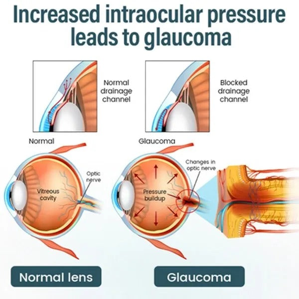 Reclaim Your Crystal-Clear Vision with Tavunae® NANO Eye Drops